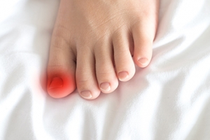 Surgery and Ingrown Toenails
